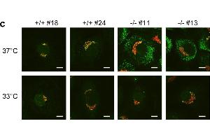 Immunofluorescence (Cultured Cells) (IF (cc)) image for anti-Collagen, Type I (COL1) antibody (ABIN5596819)