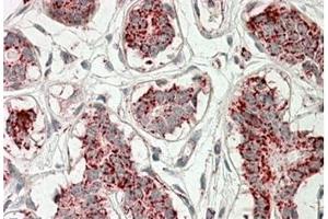AP21267PU-N ACO2 Antibody staining of paraffin embedded Human Breast at 3. (ACO2 Antikörper  (Internal Region))