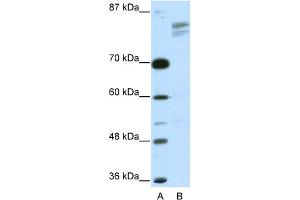 Western Blotting (WB) image for anti-General Transcription Factor III (GTF2I) (N-Term) antibody (ABIN2777491)