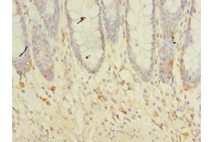 Immunohistochemistry of paraffin-embedded human colon tissue using ABIN7173211 at dilution of 1:100 (TMEM41A Antikörper  (AA 18-66))