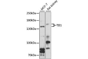 Western blot analysis of extracts of various cell lines, using TIE1 antibody (ABIN6292318) at 1:1000 dilution. (TIE1 Antikörper)