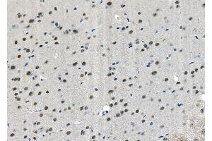 ABIN6265926 and ABIN6272455 at 1/100 staining Rat brain tissue by IHC-P. (USP36 Antikörper  (Internal Region))