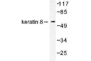 Image no. 1 for anti-Keratin 8 (KRT8) antibody (ABIN265503) (KRT8 Antikörper)