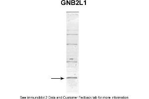 Sample Type: MCF-7 WT a whole cell lysates (110UG)Primary Dilution: 1. (GNB2L1 Antikörper  (C-Term))