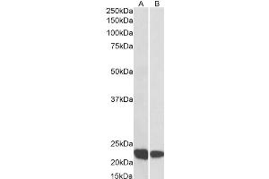 Western Blotting (WB) image for anti-Ras-Related C3 Botulinum Toxin Substrate 2 (Rho Family, Small GTP Binding Protein Rac2) (RAC2) antibody (ABIN5907554) (RAC2 Antikörper)