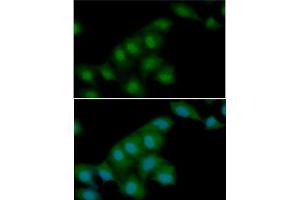 ICC/IF analysis of Visfatin in HeLa cells line, stained with DAPI (Blue) for nucleus staining and monoclonal anti-human Visfatin antibody (1:100) with goat anti-mouse IgG-Alexa fluor 488 conjugate (Green). (NAMPT Antikörper)