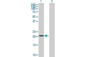 Western Blot analysis of MED18 expression in transfected 293T cell line by MED18 MaxPab polyclonal antibody. (MED18 Antikörper  (AA 1-208))
