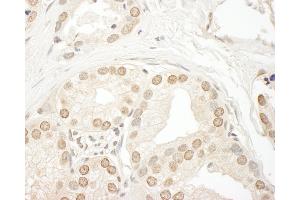 anti-Smg-9 Homolog, Nonsense Mediated mRNA Decay Factor (SMG9) (AA 75-125) antibody