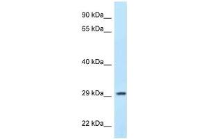 Western Blot showing PPP1R3B antibody used at a concentration of 1 ug/ml against MCF7 Cell Lysate (PPP1R3B Antikörper  (N-Term))