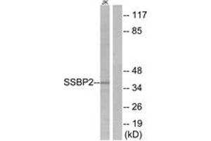 Western blot analysis of extracts from Jurkat cells, using SSBP2 Antibody. (SSBP2 Antikörper  (AA 10-59))