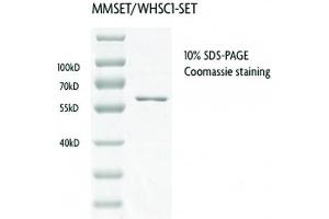 Recombinant MMSET / WHSC1 - SET protein gel.