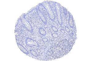 KLK7 staining is absent in all cells of the colon mucosa (Kallikrein 7 Antikörper)