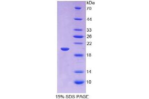 SDS-PAGE (SDS) image for Insulin-Like Growth Factor Binding Protein 2, 36kDa (IGFBP2) (AA 148-325) protein (His tag) (ABIN4988274) (IGFBP2 Protein (AA 148-325) (His tag))