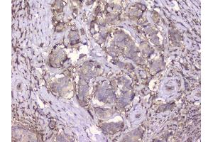 IHC analysis of Beta 2 Microglobulin using anti-Beta 2 Microglobulin antibody (ABIN6719452). (beta-2 Microglobulin Antikörper  (AA 22-119))