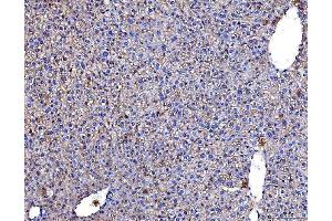 anti-Poliovirus Receptor (PVR) (AA 28-331) antibody