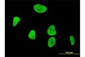 Immunofluorescence of monoclonal antibody to RUNX1 on HeLa cell. (RUNX1 Antikörper  (AA 210-310))