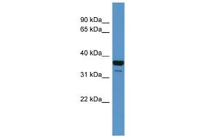 WB Suggested Anti-CD200R1 Antibody Titration: 0. (CD200R1 Antikörper  (N-Term))