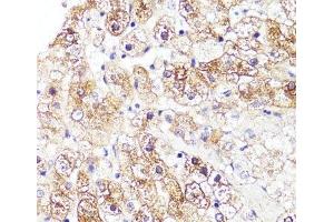 Immunohistochemistry of paraffin-embedded Human liver using CYP3A4 Polyclonal Antibody at dilution of 1:100 (40x lens). (CYP3A4 Antikörper)