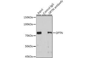 Immunoprecipitation analysis of 25 μg extracts of Mouse heart cells using 3 μg OPTN antibody (ABIN3015612, ABIN3015613, ABIN3015614 and ABIN6218972). (OPTN Antikörper  (AA 1-577))