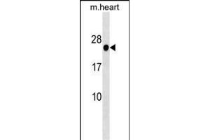 HOXB7 Antibody (Center) (ABIN1538701 and ABIN2838284) western blot analysis in mouse heart tissue lysates (35 μg/lane). (HOXB7 Antikörper  (AA 93-121))