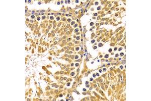 Immunohistochemistry of paraffin-embedded Rat testis using PIBF1 antibody at dilution of 1:100 (x400 lens). (PIBF1 Antikörper)