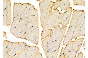 ABIN7093860 and ABIN7097903 at 1/100 staining Mouse kidney tissue by IHC-P.