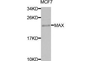 Western blot analysis of extracts of MCF7 cells, using MAX antibody. (MAX Antikörper)
