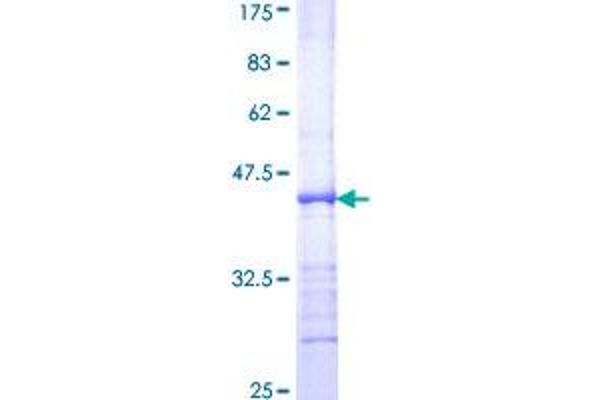 E2F2 Protein (AA 1-110) (GST tag)