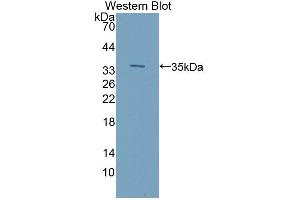Western Blotting (WB) image for anti-Integrin-Linked Kinase (ILK) (AA 183-452) antibody (ABIN5013757)
