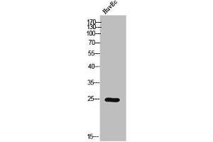 Western Blot analysis of HuvEc cells using Phospho-Casein Kinase IIβ (S209) Polyclonal Antibody (CSNK2B Antikörper  (pSer209))