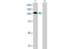 Western Blot analysis of STAT6 expression in transfected 293T cell line by STAT6 MaxPab polyclonal antibody. (STAT6 Antikörper  (AA 1-847))