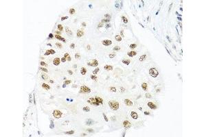 Immunohistochemistry (Paraffin-embedded Sections) (IHC (p)) image for anti-THO Complex 1 (THOC1) antibody (ABIN7264235)