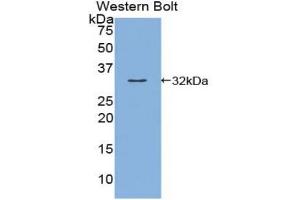 Western blot analysis of the recombinant protein. (Kallikrein 9 Antikörper  (AA 1-254))