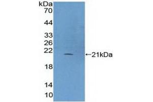 Figure. (Phospholipase C beta 3, Phosphoinositide Specific (AA 318-468) Antikörper)