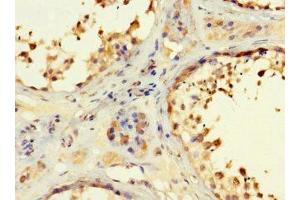 Immunohistochemistry of paraffin-embedded human testis tissue using ABIN7167050 at dilution of 1:100 (RSPH9 Antikörper  (AA 62-171))