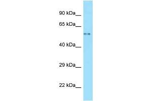 WB Suggested Anti-WASL Antibody Titration: 1. (Neural Wiskott-Aldrich syndrome protein (WASL) (Middle Region) Antikörper)