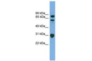 Image no. 1 for anti-SH3-Domain Kinase Binding Protein 1 (SH3KBP1) (AA 107-156) antibody (ABIN6745063) (SH3KBP1 Antikörper  (AA 107-156))