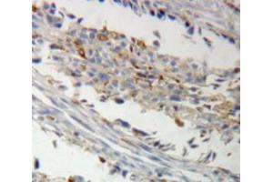 Used in DAB staining on fromalin fixed paraffin-embedded ovary tissue (AKAP12 Antikörper  (AA 1485-1782))