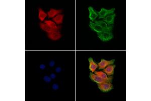 anti-Retinal Pigment Epithelium-Specific Protein 65kDa (RPE65) (N-Term) antibody
