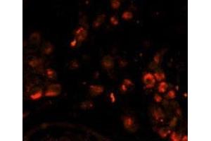 Immunofluorescence analysis of LIN28A antibody with paraffin-embedded human testis tissue. (LIN28A Antikörper)