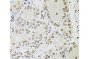 Immunohistochemistry of paraffin-embedded Human stomach using RUVBL1 Polyclonal Antibody at dilution of 1:100 (40x lens). (RUVBL1 Antikörper)