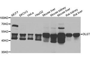 Western blot analysis of extracts of various cell lines, using DLST antibody. (DLST Antikörper)