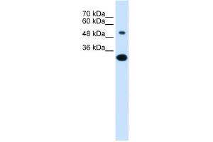 WB Suggested Anti-SLC2A5 Antibody Titration:  0. (SLC2A5 Antikörper  (Middle Region))