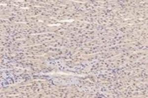 Immunohistochemistry analysis of paraffin-embedded mouse kidney using,PFDN4 (ABIN7075171) at dilution of 1: 4200 (PFDN4 Antikörper)