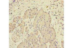 Immunohistochemistry of paraffin-embedded human pancreatic tissue using ABIN7168641 at dilution of 1:100 (SCFD1 Antikörper  (AA 373-642))