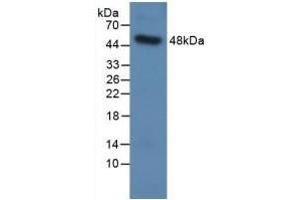 Detection of Recombinant SPC, Human using Polyclonal Antibody to Surfactant Protein C (SP-C) (Surfactant Protein C Antikörper  (AA 24-197))