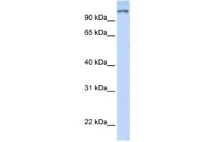 Western Blotting (WB) image for anti-Poly (ADP-Ribose) Polymerase Family, Member 9 (PARP9) antibody (ABIN2458048) (PARP9 Antikörper)