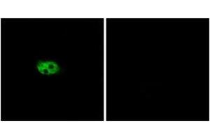 Immunofluorescence analysis of A549 cells, using NK3R Antibody. (TACR3 Antikörper  (AA 401-450))