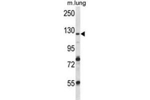 VPS54 Antibody (Center) western blot analysis in mouse lung tissue lysates (35 µg/lane). (VPS54 Antikörper  (Middle Region))