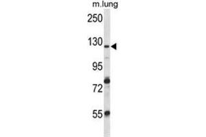 Western Blotting (WB) image for anti-Vacuolar Protein Sorting 54 Homolog (VPS54) (AA 464-491), (Middle Region) antibody (ABIN955528)